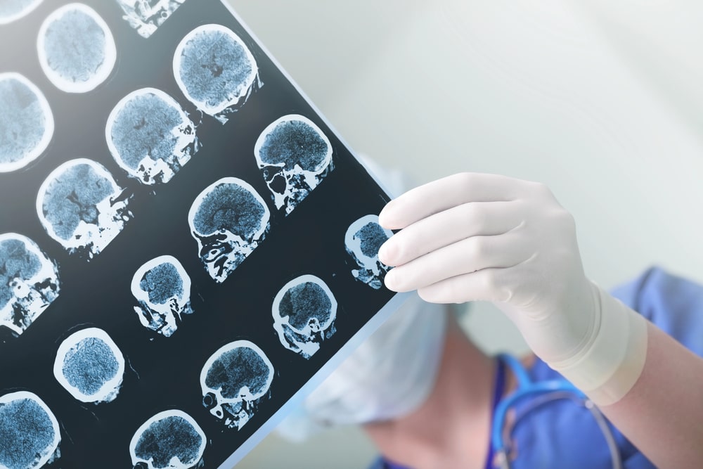 Brain Injury Lawyer In Las Vegas